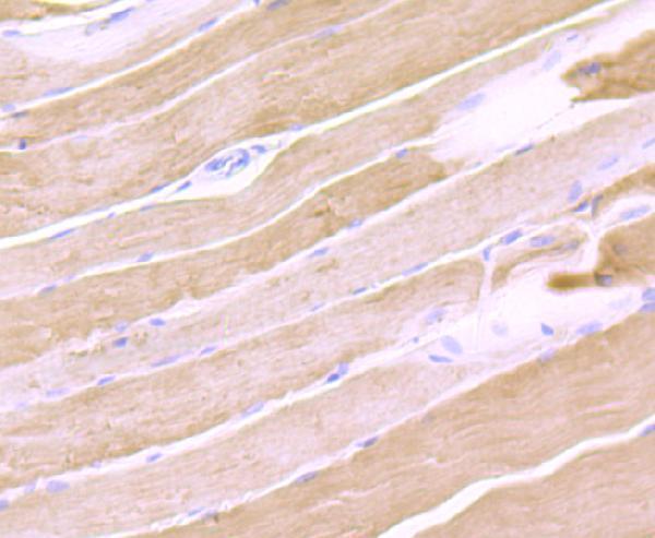Immunohistochemical analysis of paraffin-embedded rat skeletal muscle tissue using anti-Calsequestrin 1 antibody