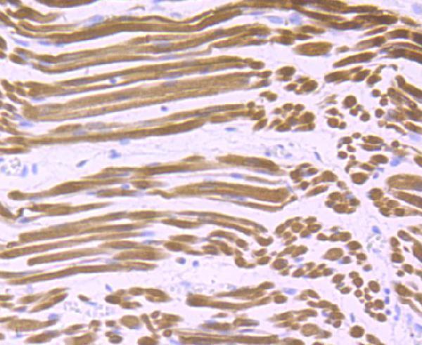 Immunohistochemical analysis of paraffin-embedded human fetal skeletal muscle tissue using anti-Calsequestrin 1 antibody