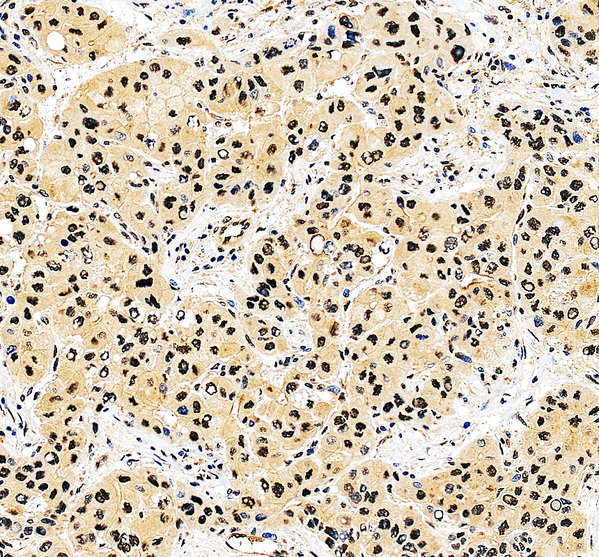 a05237 1 gps1 primary antibodies ihc testing 1
