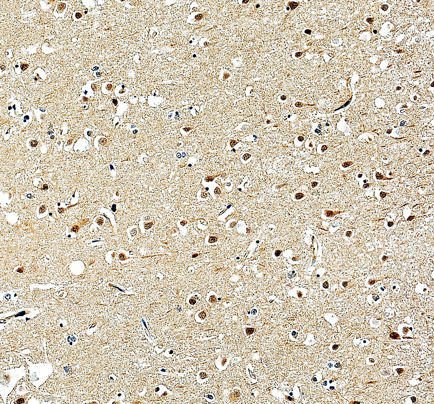a05237 1 gps1 primary antibodies ihc testing 2