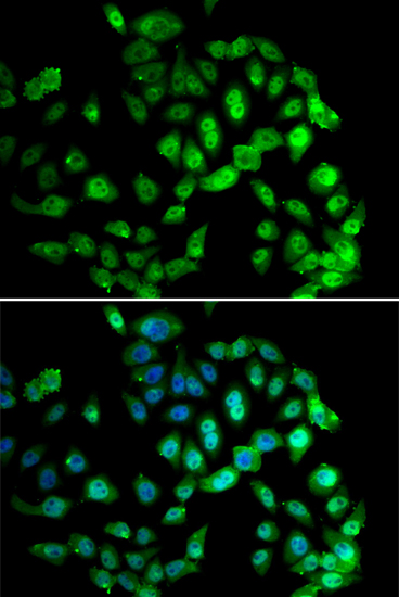 a05237 gps1 primary antiboties ihc testing 2