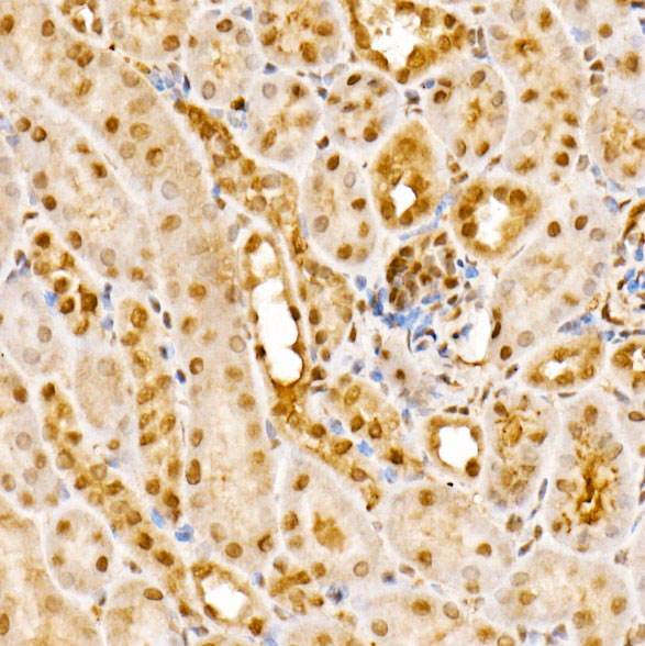 a05237 gps1 primary antiboties ihc testing 3