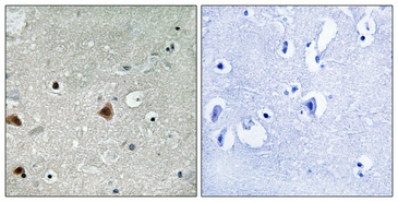 a05237s454 gps1 primary antibodyes ihc testing 1