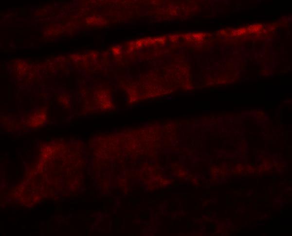 Immunofluorescence of ADORA2B in rat colon tissue with ADORA2B antibody at 20 μg/mL