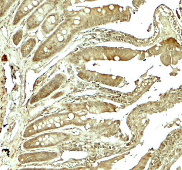 Immunohistochemistry of ADORA2B in rat colon tissue with ADORA2B antibody at 5 μg/mL