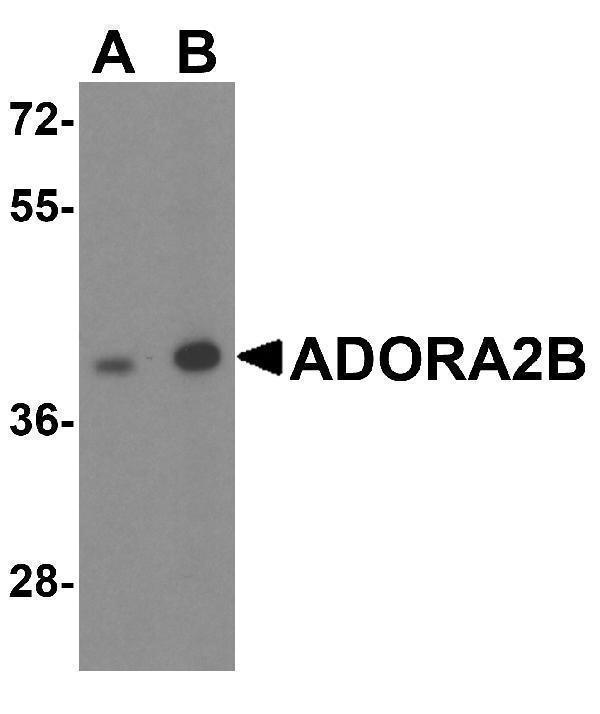 Western blot analysis of ADORA2B in mouse kidney tissue lysate with ADORA2B antibody at (A) 0