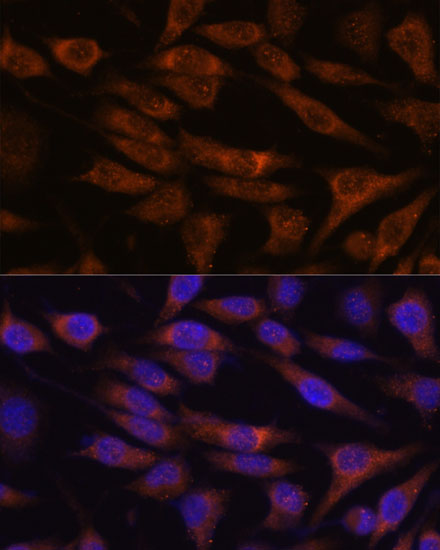 a05240 unc13b primary antiboties if testing 3