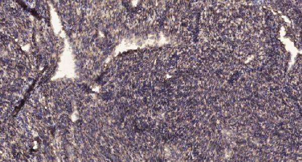 Immunohistochemical analysis of paraffin-embedded human uterus