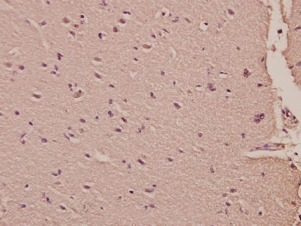 a05242 1 hars primary antiboties ihc testing 2
