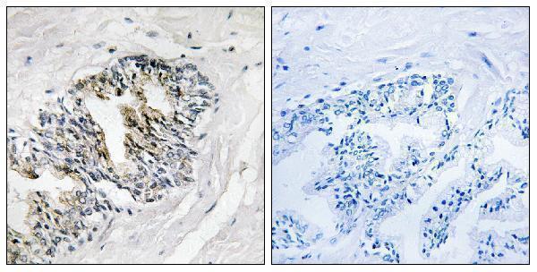 a05244 1 rplp2 primary antibodies ihc testing 1