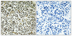 Immunohistochemistry validation of CEP152 using Anti-Centrosomal protein of 152 kDa CEP152 Antibody (A05246-1)
