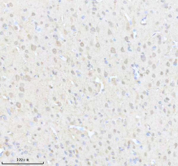 IHC analysis of CPLX1 using anti-CPLX1 antibody (A05254)