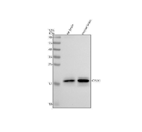 Western blot analysis of CPLX1 using anti-CPLX1 antibody (A05254)