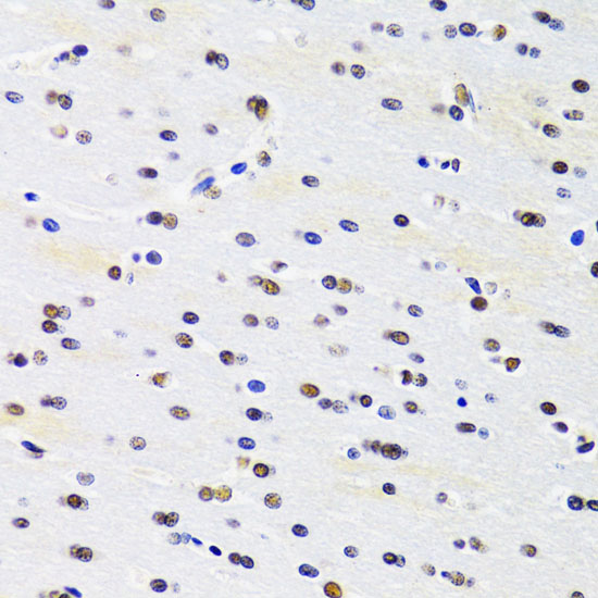 Immunohistochemistry of paraffin-embedded rat brain using PRPF3 Antibody  at dilution of 1:100 
