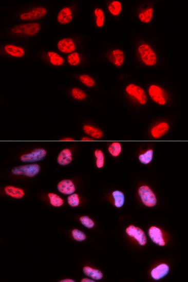 Immunohistochemistry of paraffin-embedded human stomach using PRPF3 Antibody  at dilution of 1:100 