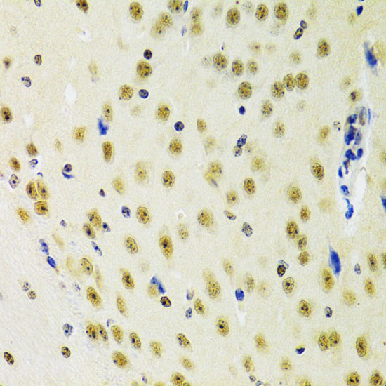 a05255 prpf3 primary antiboties ihc testing 4