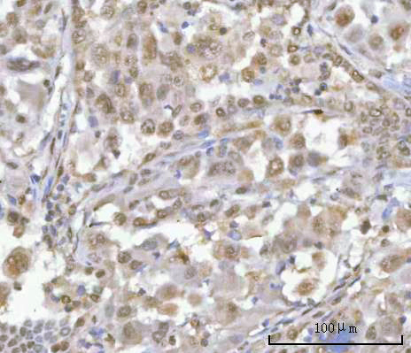  IHC analysis of HOXD10 using anti-HOXD10 antibody (A05257-2)