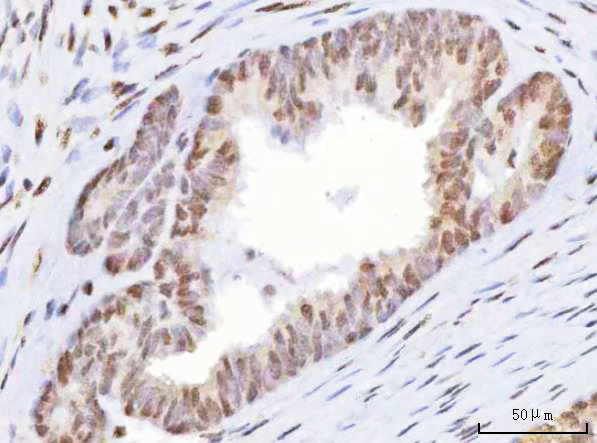  IHC analysis of HOXD10 using anti-HOXD10 antibody (A05257-2)