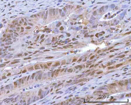 a05257 2 hoxd10 primary antibodies ihc testing 4