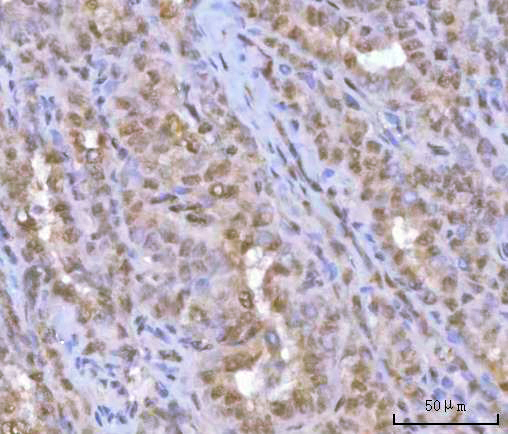 a05257 2 hoxd10 primary antibodies ihc testing 5