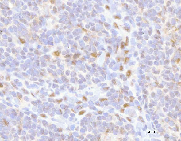a05257 2 hoxd10 primary antibodies ihc testing 6