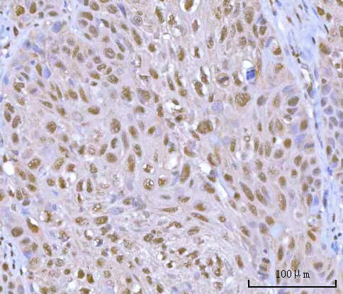 a05257 2 hoxd10 primary antibodies ihc testing 7