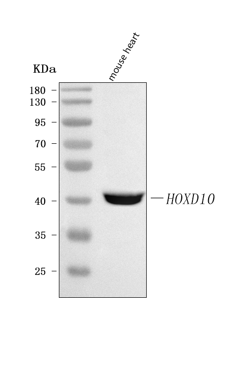  Western blot analysis of HOXD10 using anti-HOXD10 antibody (A05257-2)