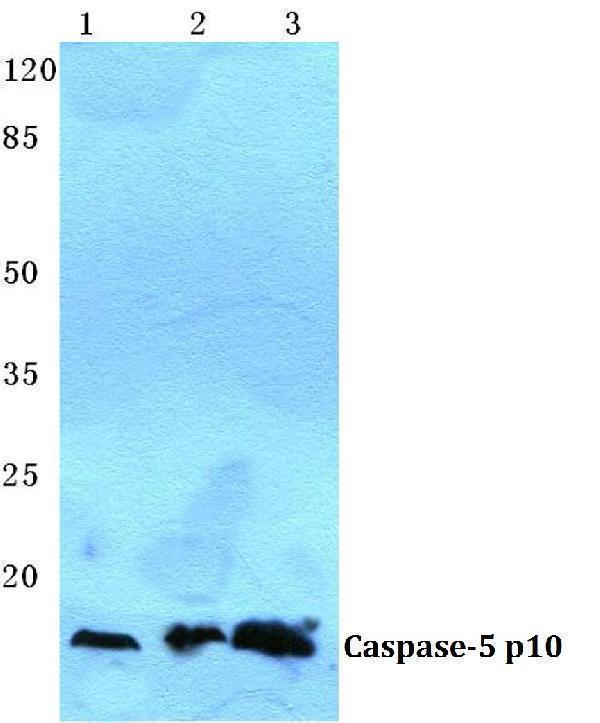 Western blot (WB) analysis of Caspase 5 p10 polyclonal antibody at 1:500 dilution
Lane1:Jurkat cell lysate
Lane2:Mouse liver tissue lysate
Lane3:Rat liver tissue lysate