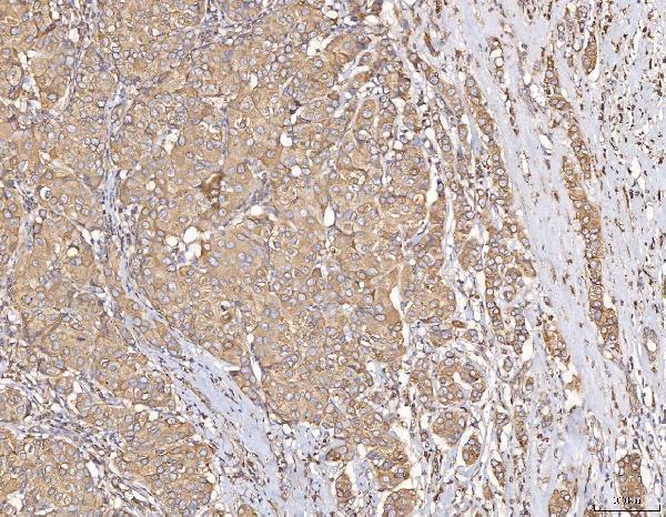  IHC analysis of Calmegin/CLGN using anti-Calmegin/CLGN antibody (A05261-1)