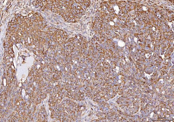 IHC analysis of Calmegin/CLGN using anti-Calmegin/CLGN antibody (A05261-1)