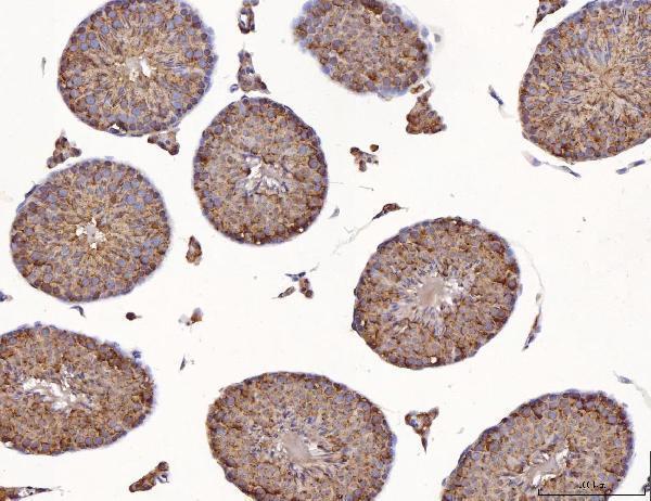 a05261 1 clgn primary antibodies ihc testing 4