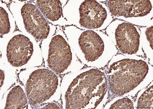 a05261 1 clgn primary antibodies ihc testing 5