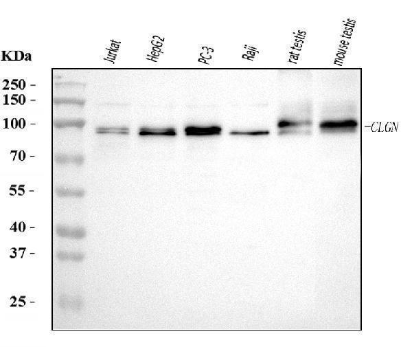  Western blot analysis of Calmegin/CLGN using anti-Calmegin/CLGN antibody (A05261-1)