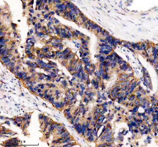 IHC analysis of UBE2A/2B using anti-UBE2A/2B antibody (A05264-2)