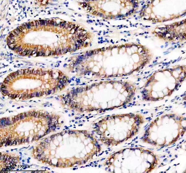 IHC analysis of UBE2A/2B using anti-UBE2A/2B antibody (A05264-2)