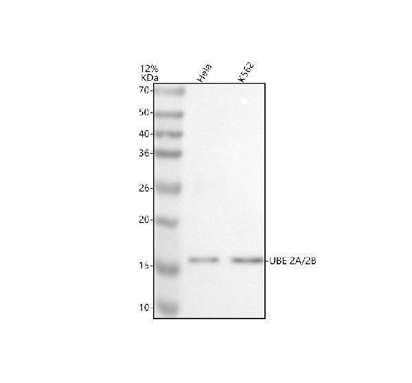 Western blot analysis of UBE2A/2B using anti-UBE2A/2B antibody (A05264-2)