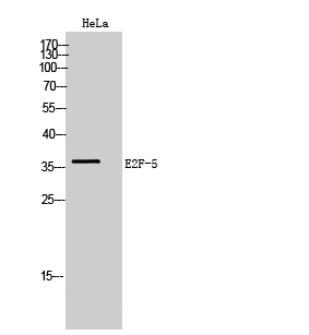 Western blotting validation for Anti-E2F-5 Antibody A05265
Western Blot (WB) analysis of HeLa cells using E2F-5 polyclonal antibody