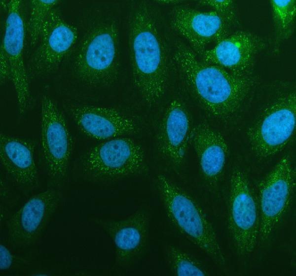a05268 1 rps3a primary antibodies if testing 1