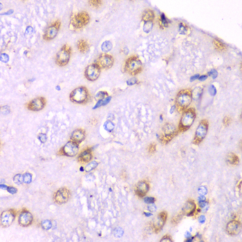 a05268 rps3a primary antiboties ihc testing 2