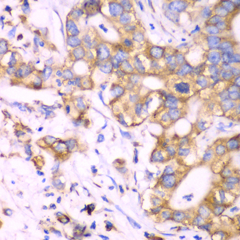 a05268 rps3a primary antiboties ihc testing 3