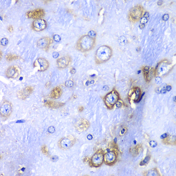 a05268 rps3a primary antiboties ihc testing 4