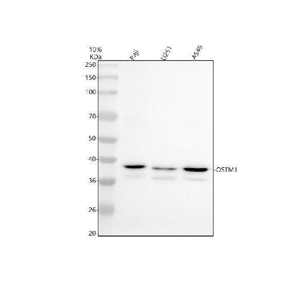 Western blot analysis of OSTM1 using anti-OSTM1 antibody (A05269-1)