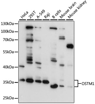 a05269 ostm1 primary antiboties wb testing 1