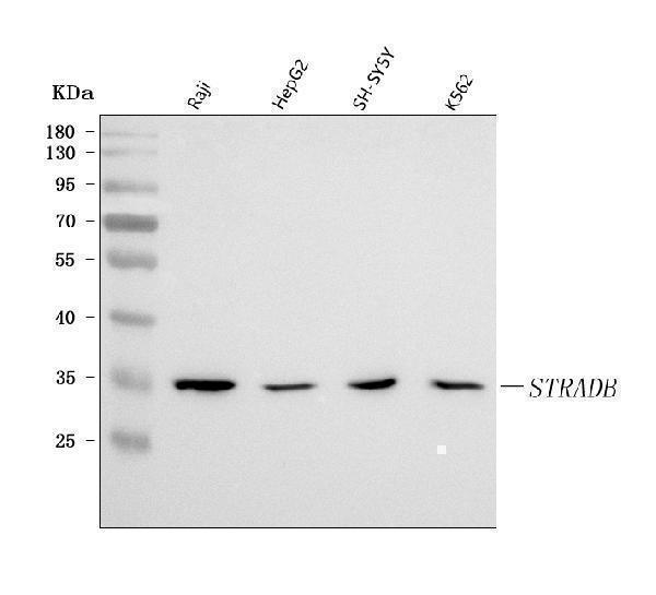  Western blot analysis of STRADB using anti-STRADB antibody (A05271-2)