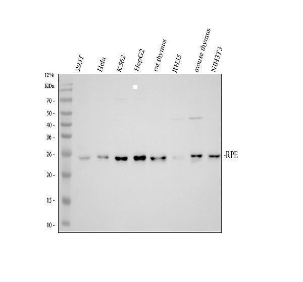 Western blot analysis of RPE using anti-RPE antibody (A05272-1)