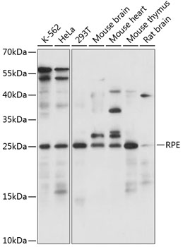a05272 rpe primary antiboties wb testing 1