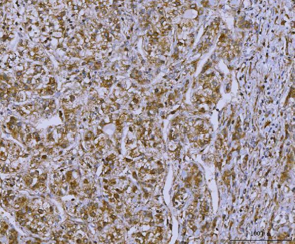  IHC analysis of OAT2/SLC22A7 using anti-OAT2/SLC22A7 antibody (A05273-2)