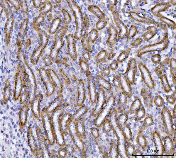  IHC analysis of OAT2/SLC22A7 using anti-OAT2/SLC22A7 antibody (A05273-2)