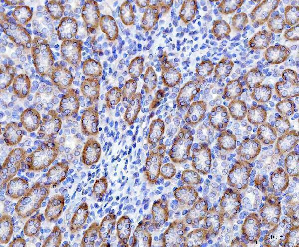 a05273 2 slc22a7 primary antibodies ihc testing 4