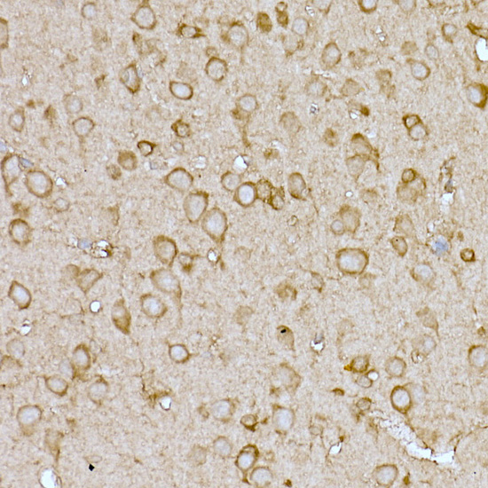 Immunohistochemistry of paraffin-embedded mouse brain using SLC7A1 Rabbit pAb  at dilution of 1:100 